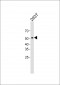 p53 Antibody